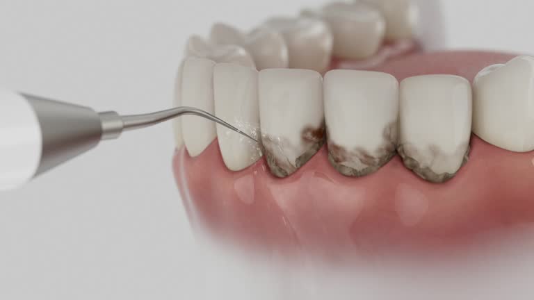 Reliable Dental contractor in Ramsey, MN by Dentist Open Now
